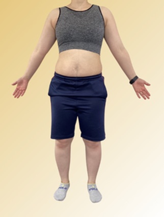 40代女性 ダイエット Before